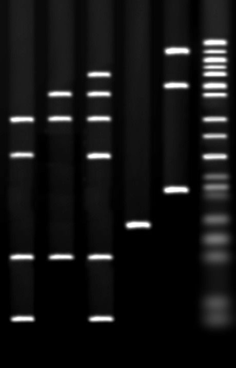 Gel stained with ethidium bromide